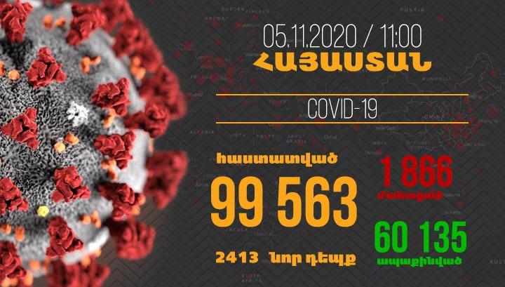 Հայաստանում գրանցվել է կորոնավիրուսի 2413, մահվան՝ 29 նոր դեպք