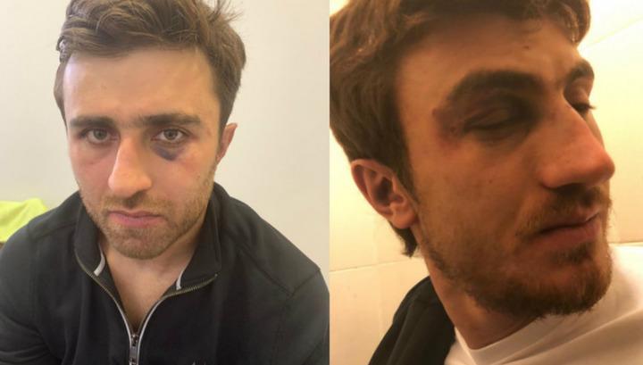 Մալաքյան եղբայրներին մեղադրանք է առաջադրվել