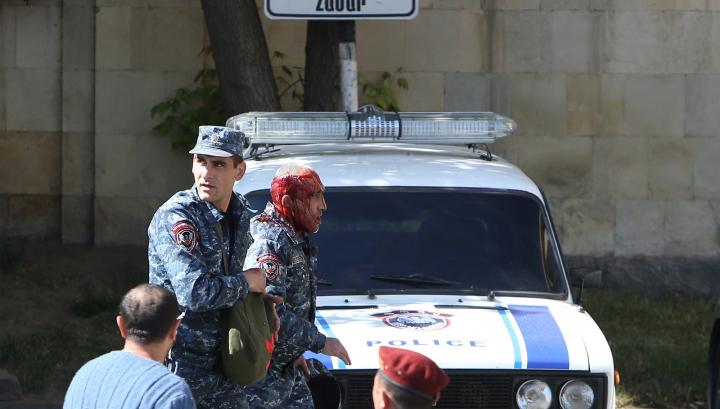 Հիվանդանոցային բուժում է ստանում 5 ցուցարար և մեկ ոստիկան