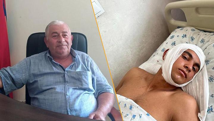 Զարթոնք համայնքում ո՞վ և ինչո՞ւ է դաժան ծեծի ենթարկել 16 -ամյա պատանուն և նրա հորը. 168.am