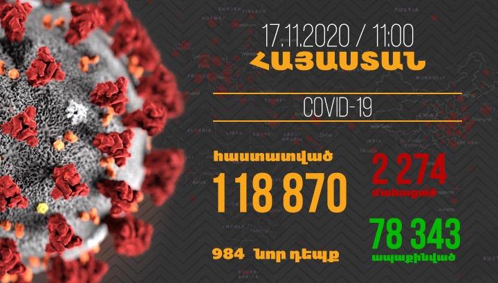 Հայաստանում գրանցվել է կորոնավիրուսի 984 նոր դեպք, մահվան՝ 36