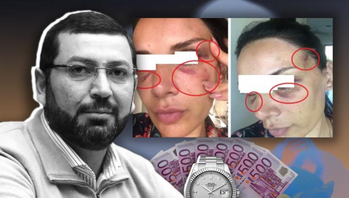 Իր կնոջը ծեծող Բաքոյանը հետաքրքրվում է ուրիշների կուսությամբ․ Politik.am