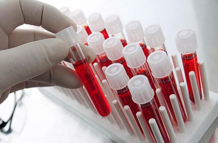 Որոնք են այս պահին առավել անհրաժեշտ արյան խմբերը