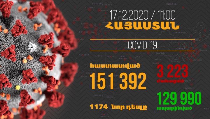 Հայաստանում գրանցվել է կորոնավիրուսի 1174 նոր դեպք, մահվան՝ 30