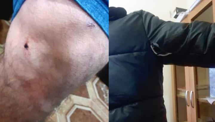 Մատաղիս-Քարվաճառ հատվածում վեճ է տեղի ունեցել հայերի ու երթևեկող ադրբեջանիցիների միջև. կան վիրավորներ