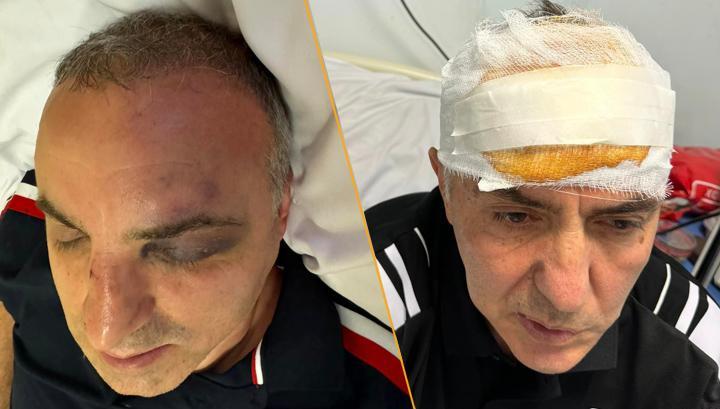 Արցախցի եղբայրներին ծանր մարմնական վնասվածք պատճառելու համար մեկ անձի նկատմամբ քրեական հետապնդում է հարուցվել