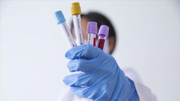 Արտադպրոցական կենտրոնների համար COVID-19-ի կանխարգելման նպատակով սահմանվել են առանձին պահանջներ