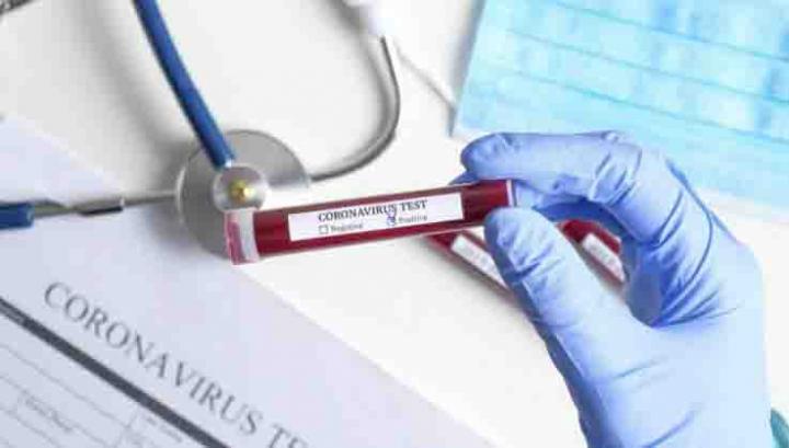 Կորոնավիրուսով վարակվածների թիվը հասավ 64-ի