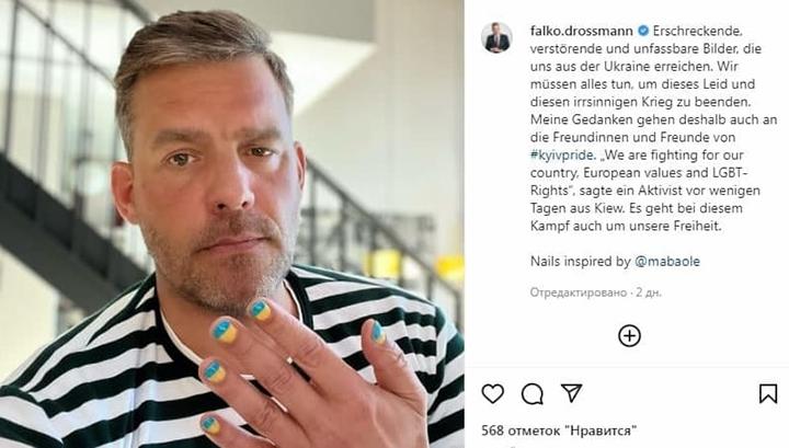 Եվրոպան արձագանքում է Զելենսկուն. գերմանացի պատգամավորը եղունգները ներկել է Ուկրաինայի դրոշի գույներով